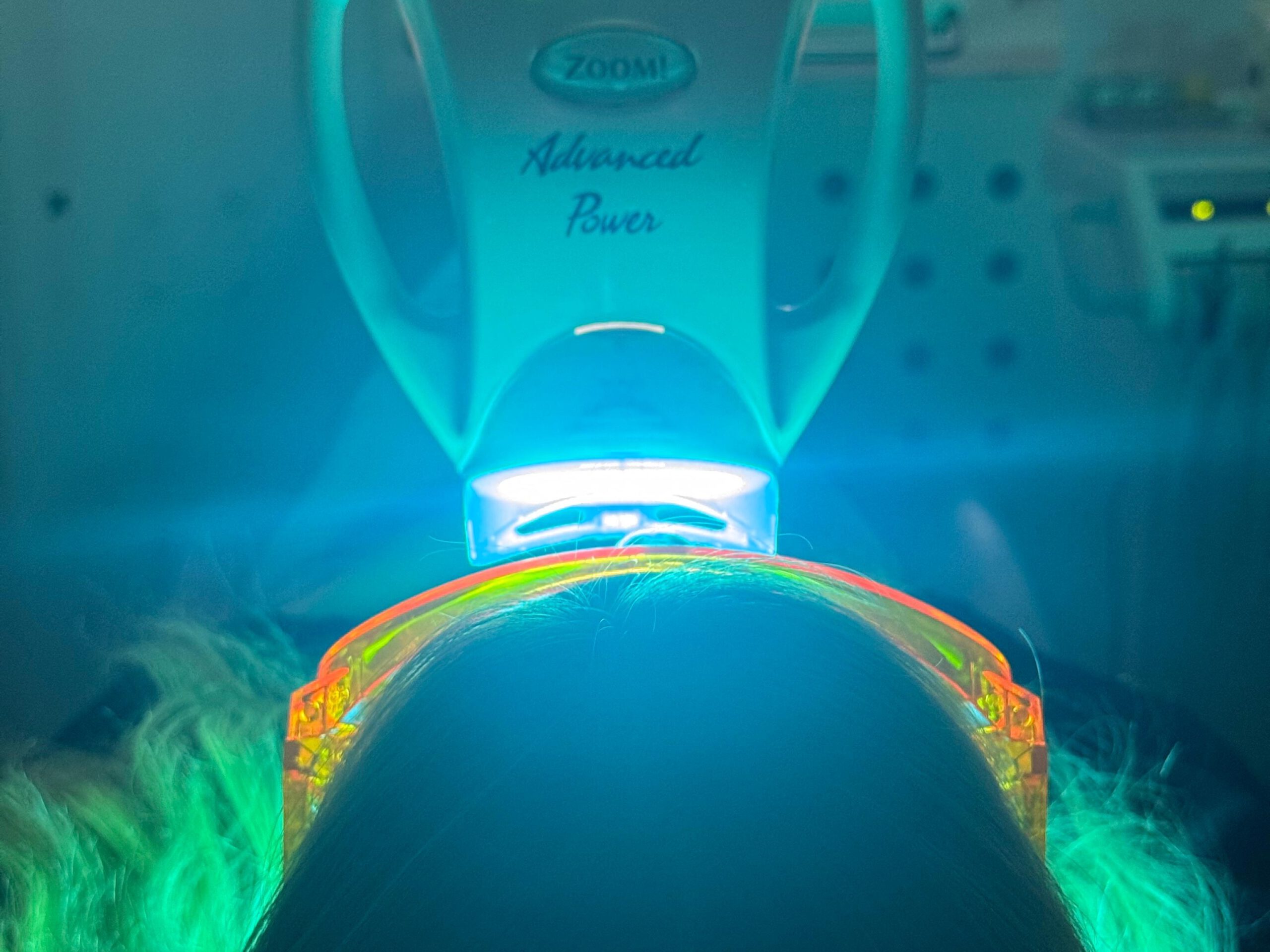 Bleaching mit Zoom Advanced Power Lampe in der Zahnarztpraxis Bordas-Semmelweis in Singen – professionelle Zahnaufhellung mit Lichtaktivierung